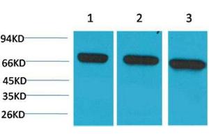Western Blot (WB) analysis of 1) HeLa, 2)Mouse Brain Tissue, 3) Rat Brain Tissue with HSC70 Mouse Monoclonal Antibody diluted at 1:2000. (Hsc70 Antikörper)