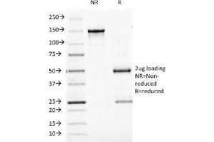 SDS-PAGE Analysis Purified Chromogranin A Monoclonal Antibody (CGA/413).