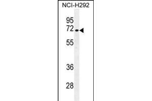 NUMB Antibody (N-term) (ABIN655396 and ABIN2844944) western blot analysis in NCI- cell line lysates (35 μg/lane). (NUMB Antikörper  (N-Term))