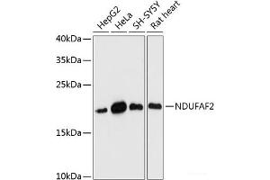Western blot analysis of extracts of various cell lines using NDUFAF2 Polyclonal Antibody at dilution of 1:3000. (NDUFAF2 Antikörper)
