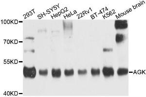 Western blot analysis of extracts of various cell lines, using AGK antibody. (Acylglycerol Kinase Antikörper  (AA 233-422))