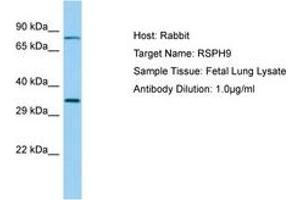 Image no. 1 for anti-Radial Spoke Head 9 Homolog (RSPH9) (AA 99-148) antibody (ABIN6749894) (RSPH9 Antikörper  (AA 99-148))