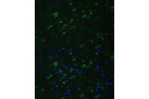 Immunofluorescence (IF) image for anti-Myeloid/lymphoid Or Mixed-Lineage Leukemia 5 (Trithorax Homolog) (MLL5) (AA 200-500) antibody (ABIN6142983)