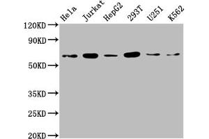 Western Blot Positive WB detected in: Hela whole cell lysate, Jurkat whole cell lysate, HepG2 whole cell lysate, 293T whole cell lysate, U251 whole cell lysate, K562 whole cell lysate All lanes: NUP58 antibody at 1:2000 Secondary Goat polyclonal to rabbit IgG at 1/50000 dilution Predicted band size: 61, 51, 60 kDa Observed band size: 65 kDa (NUPL1 Antikörper  (AA 211-480))