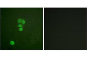 Immunofluorescence analysis of A549 cells, using SOX9 (Ab-181) Antibody. (SOX9 Antikörper  (AA 147-196))