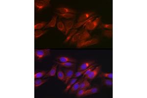 Immunofluorescence analysis of U2OS cells using Raptor Rabbit pAb (ABIN7269901) at dilution of 1:50 (40x lens). (Raptor Antikörper)