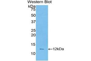 Western blot analysis of the recombinant protein. (Caspase 4 Antikörper  (AA 290-377))