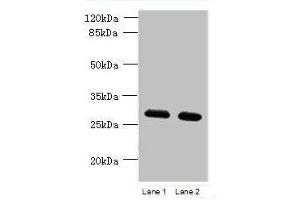Western blot All lanes: TMEM38B antibody at 1. (TMEM38B Antikörper  (AA 249-291))