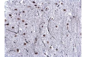 IHC-P Image CBX1 / HP1 beta antibody detects CBX1 / HP1 beta protein at nucleus on mouse middle brain by immunohistochemical analysis. (CBX1 Antikörper  (Center))