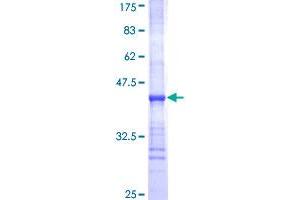 UGT2B10 Protein (AA 62-159) (GST tag)