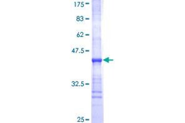 UGT2B10 Protein (AA 62-159) (GST tag)