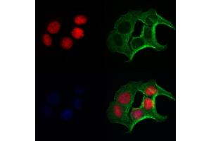 FLCN Antibody staining Hela cells by IF/ICC. (FLCN Antikörper  (N-Term))