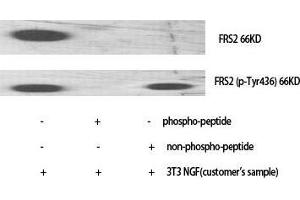 Western Blot (WB) analysis of specific cells using Phospho-FRS2 (Y436) Polyclonal Antibody. (FRS2 Antikörper  (pTyr436))