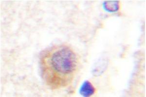 Image no. 2 for anti-Rabphilin 3A (RPH3A) antibody (ABIN272075) (RPH3A Antikörper)