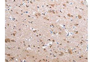 The image on the left is immunohistochemistry of paraffin-embedded Human brain tissue using ABIN7190229(CFC1 Antibody) at dilution 1/20, on the right is treated with synthetic peptide. (CFC1 Antikörper)