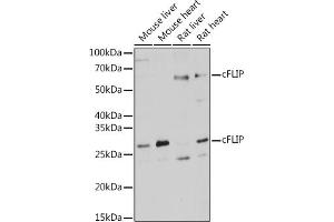 Western blot analysis of extracts of various cell lines, using cFLIP antibody (ABIN3016246, ABIN3016247, ABIN3016248 and ABIN6219655) at 1:1000 dilution. (FLIP Antikörper  (AA 161-480))