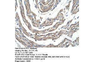 Immunohistochemistry (IHC) image for anti-serine/threonine Kinase 11 (STK11) (N-Term) antibody (ABIN2776968)