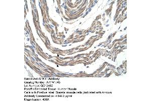 Rabbit Anti-STK11 Antibody  Paraffin Embedded Tissue: Human Muscle Cellular Data: Skeletal muscle cells Antibody Concentration: 4. (LKB1 Antikörper  (N-Term))