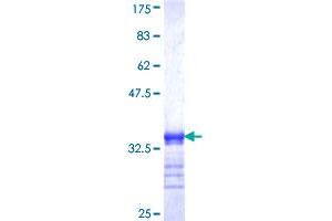 Image no. 1 for Thymidine Kinase 1, Soluble (TK1) (AA 157-234) protein (GST tag) (ABIN1322822)
