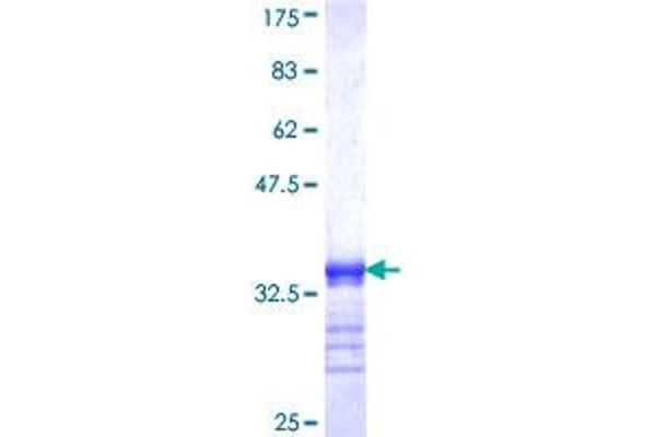 TK1 Protein (AA 157-234) (GST tag)