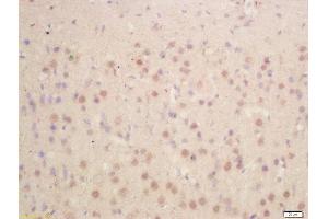 Formalin-fixed and paraffin embedded rat brain labeled with Anti-HES1 Polyclonal Antibody, Unconjugated  at 1:200 followed by conjugation to the secondary antibody and DAB staining (HES1 Antikörper  (AA 41-150))