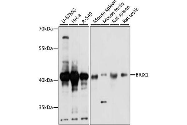 BRIX1 抗体  (AA 1-353)