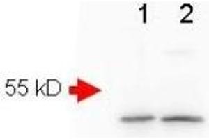 Image no. 3 for anti-Amyloid beta (Abeta) (AA 1-14), (N-Term) antibody (ABIN401205) (beta Amyloid Antikörper  (N-Term))