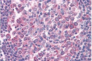 Immunohistochemistry (IHC) image for anti-TNF Receptor Superfamily, Member 6 (FAS) (Internal Region) antibody (ABIN571054)