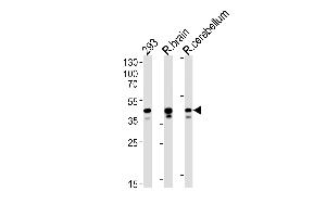 Rat Csnk2a1 Antibody (N-term) (ABIN1881717 and ABIN2843635) western blot analysis in 293 cell line , rat brain and cerebellum tissue lysates (35 μg/lane).