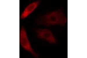 ABIN6274618 staining COLO205 cells by IF/ICC. (CDKAL1 Antikörper  (N-Term))