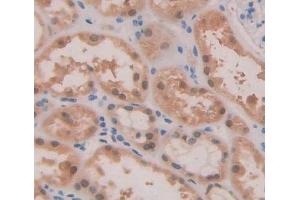 Used in DAB staining on fromalin fixed paraffin- embedded kidney tissue (ABCA2 Antikörper  (AA 2201-2436))