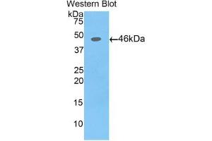 Detection of Recombinant AFP,Pig using Polyclonal Antibody to Alpha-Fetoprotein (AFP) (alpha Fetoprotein Antikörper  (AA 46-210))