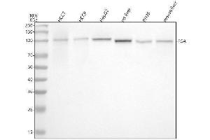 Western blot analysis of Fibrinogen Alpha Chain using anti-Fibrinogen Alpha Chain antibody (ABIN7604849).