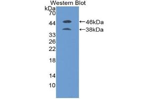 Western blot analysis of the recombinant protein. (PLGF Antikörper  (AA 19-158))