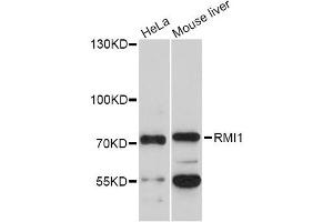 Western blot analysis of extracts of various cell lines, using RMI1 Antibody (ABIN5972890) at 1/1000 dilution. (RMI1 Antikörper)