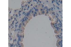 Used in DAB staining on fromalin fixed paraffin- embedded Kidney tissue (CD101 Antikörper  (AA 302-531))