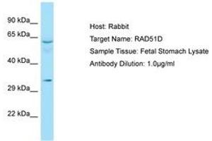 Image no. 1 for anti-RAD51 Homolog D (RAD51D) (AA 259-308) antibody (ABIN6749950) (RAD51D Antikörper  (AA 259-308))