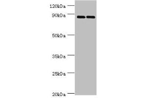 Western blot All lanes: SET and MYND domain-containing protein 4 antibody at 4 μg/mL Lane 1: HepG2 whole cell lysate Lane 2: Hela whole cell lysate Secondary Goat polyclonal to rabbit IgG at 1/10000 dilution Predicted band size: 89 kDa Observed band size: 89 kDa (SMYD4 Antikörper  (AA 1-260))