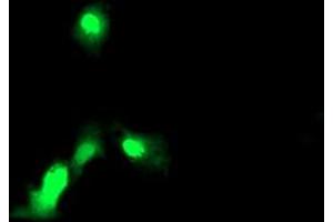 Anti-EXOSC7 mouse monoclonal antibody (ABIN2455505) immunofluorescent staining of COS7 cells transiently transfected by pCMV6-ENTRY EXOSC7 (RC201419). (EXOSC7 Antikörper)