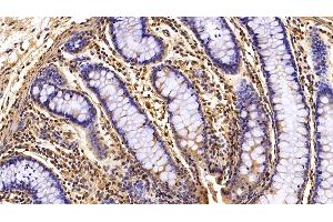 Immunohistochemistry (IHC) image for anti-Interleukin 8 (IL8) (AA 23-101) antibody (ABIN7429835)