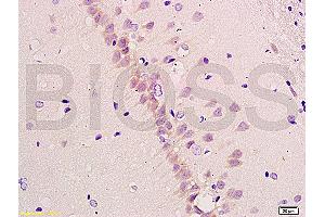 Formalin-fixed and paraffin embedded rat brain tissue labeled with Anti-beta-Amyloid 1-40 (CT) Polyclonal Antibody, Unconjugated (ABIN729328) at 1:200, followed by conjugation to the secondary antibody and DAB staining (Abeta 1-40 Antikörper  (C-Term))