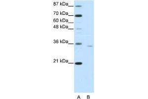 WB Suggested Anti-OTP Antibody Titration:  0.