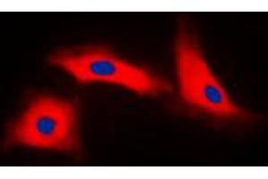 Immunofluorescent analysis of APAF-1 staining in HeLa cells. (APAF1 Antikörper  (C-Term))