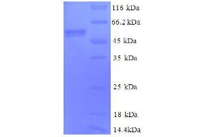 Cytochrome C1 (CYC1) (AA 85-325), (full length) protein (GST tag) (Cytochrome C1 Protein (CYC1) (AA 85-325, full length) (GST tag))