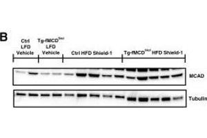 MCD induction suppresses the fatty acid oxidative pathway. (Medium-Chain Specific Acyl-CoA Dehydrogenase, Mitochondrial (MCAD) (Center) Antikörper)
