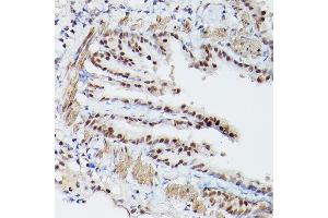 Immunohistochemistry of paraffin-embedded mouse lung using PSME3 Rabbit pAb (ABIN6135015, ABIN6146357, ABIN6146358 and ABIN6216428) at dilution of 1:100 (40x lens). (PSME3 Antikörper  (C-Term))