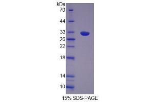 SDS-PAGE analysis of Human OS9 Protein. (OS9 Protein)