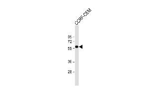 Anti-SLC22A6 Antibody (C-Term) at 1:1000 dilution + CCRF-CEM whole cell lysate Lysates/proteins at 20 μg per lane. (SLC22A6 Antikörper  (C-Term))