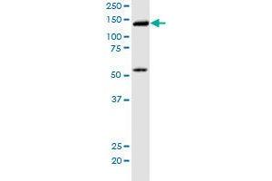 KIF5B monoclonal antibody (M01), clone 2A11. (KIF5B Antikörper  (AA 864-962))