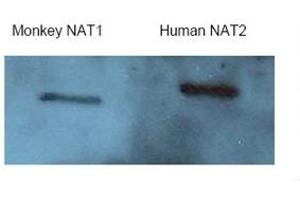 Western Blotting (WB) image for anti-N-Acetyltransferase 2 (Arylamine N-Acetyltransferase) (NAT2) (Middle Region) antibody (ABIN2781757)
